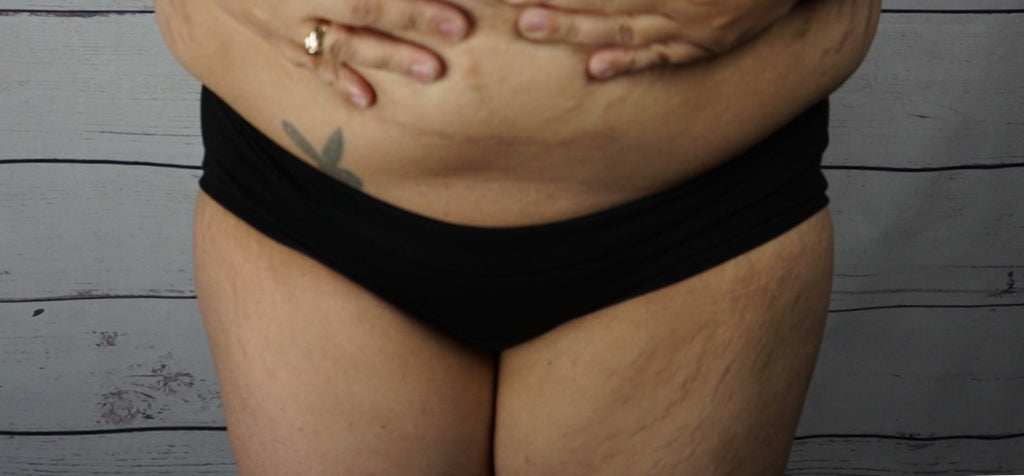 MyFit Underwear